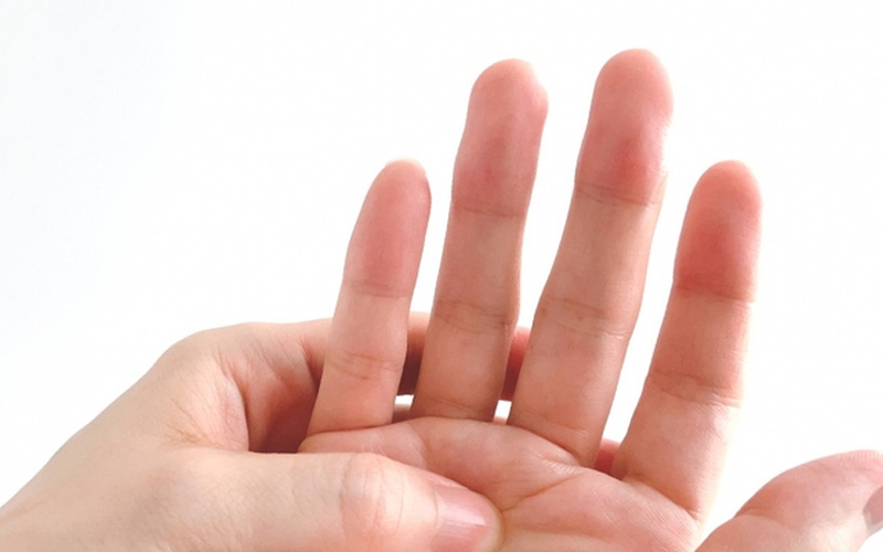 腱鞘炎（ばね指）